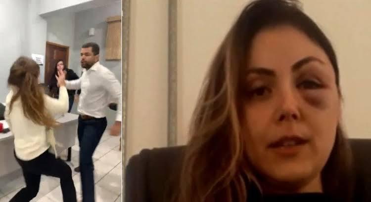 Polícia Civil pede prisão preventiva de agressor de procuradora-geral no interior de SP