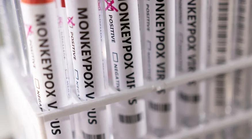 São Paulo registra segunda morte por varíola dos macacos