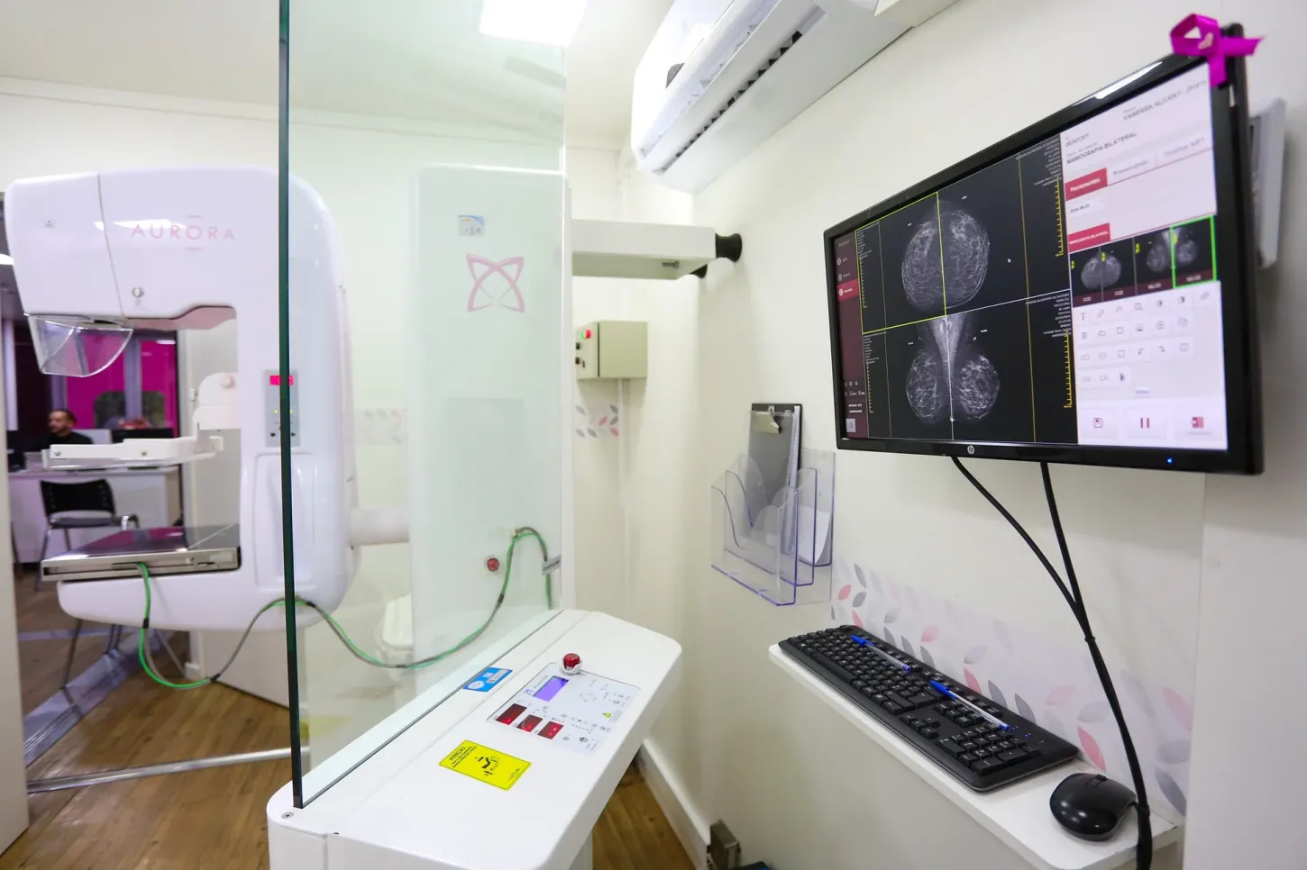 Tabela SUS Paulista amplia acesso ao tratamento do câncer de mama