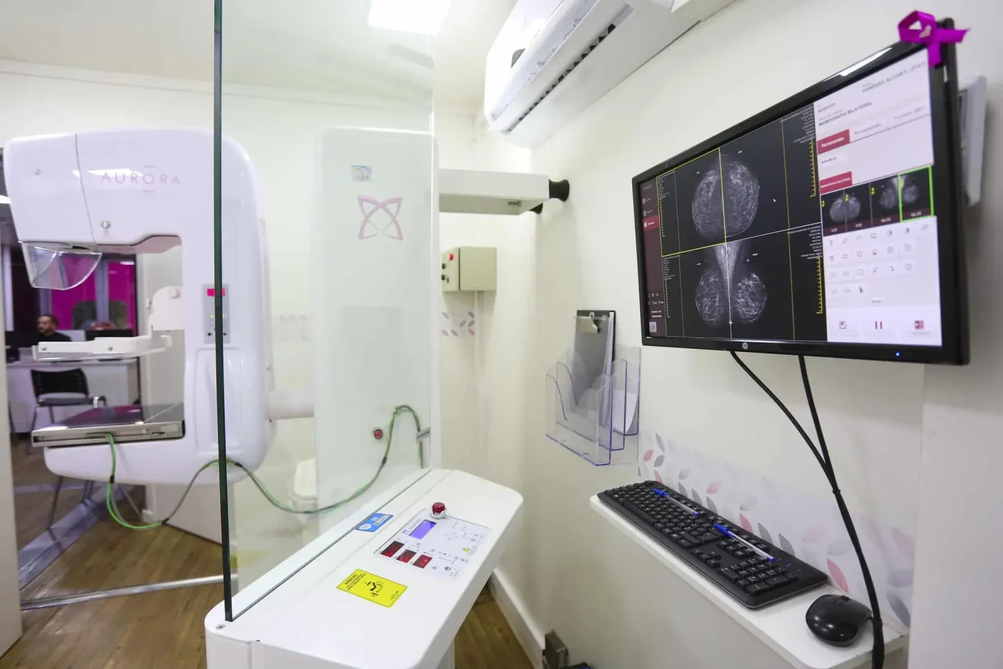 Carretas de prevenção ao câncer de mama realizam exames gratuitos em cinco municípios paulistas; confira
